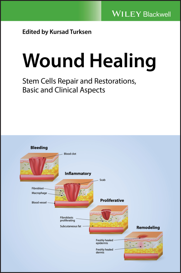 Wound Healing. Stem Cells Repair and Restorations, Basic and Clinical Aspects