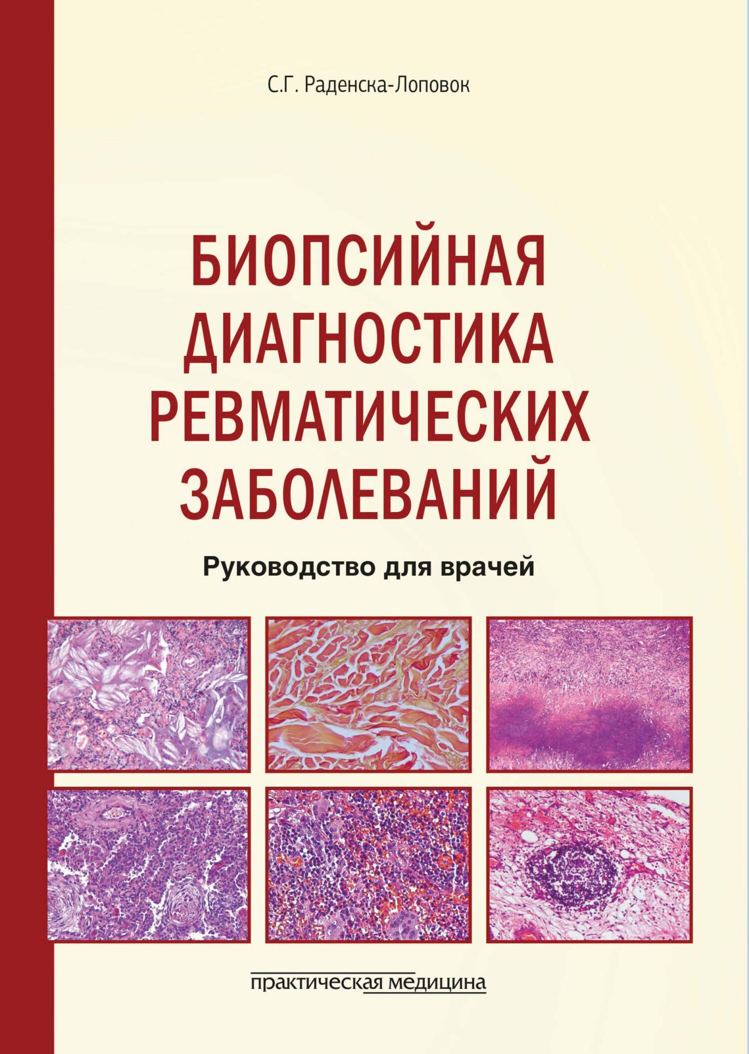 Биопсийная диагностика ревматических заболеваний. Руководство для врачей,  Стефка Раденска-Лоповок – скачать pdf на ЛитРес