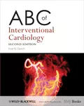 ABC of Interventional Cardiology - Ever Grech D.