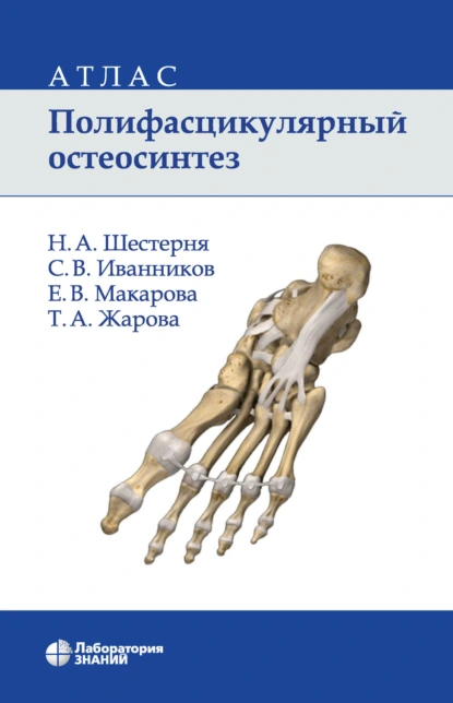 Обложка книги Полифасцикулярный остеосинтез. Атлас, Н. А. Шестерня