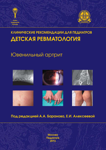 

Ювенильный артрит. Детская ревматология