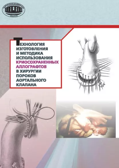 Обложка книги Технология изготовления и методика использования криосохраненных аллографтов в хирургии пороков аортального клапана, Ю. П. Островский