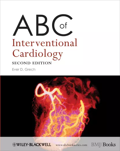 Обложка книги ABC of Interventional Cardiology, Ever Grech D.