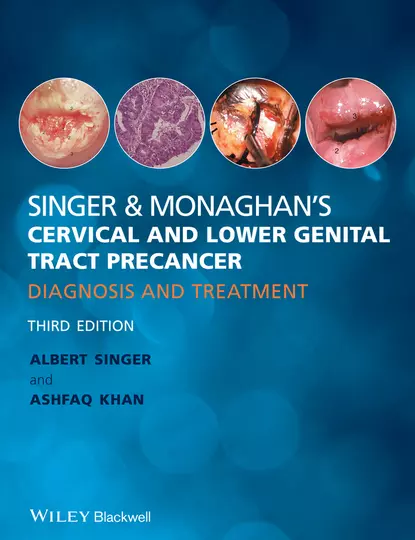 Обложка книги Singer & Monaghan's Cervical and Lower Genital Tract Precancer. Diagnosis and Treatment, Singer Albert