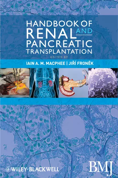 Обложка книги Handbook of Renal and Pancreatic Transplantation, Fronek Jiri