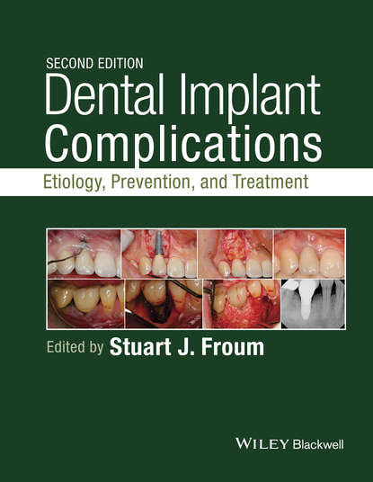 Dental Implant Complications - Группа авторов