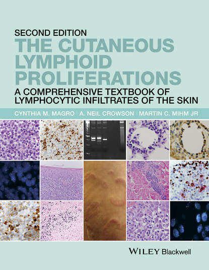 The Cutaneous Lymphoid Proliferations - A. Neil Crowson