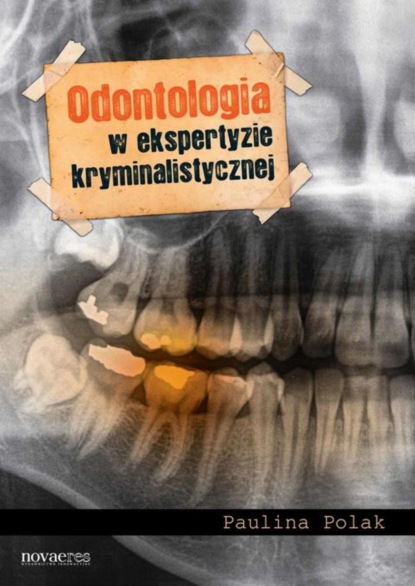 Paulina Polak - Odontologia w ekspertyzie kryminalistycznej