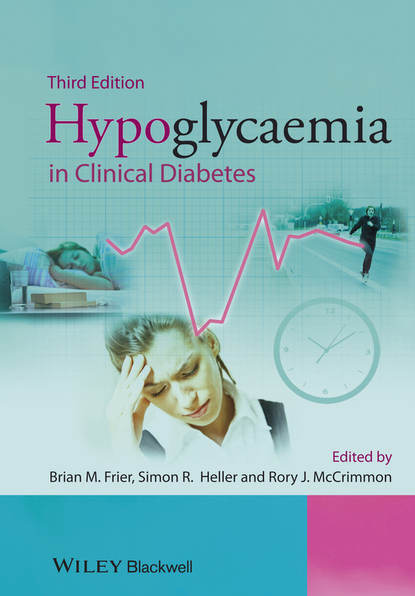 Simon  Heller - Hypoglycaemia in Clinical Diabetes