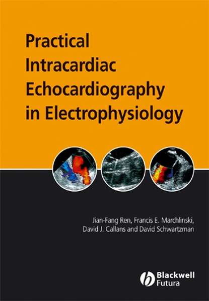 Jian-Fang  Ren - Practical Intracardiac Echocardiography in Electrophysiology