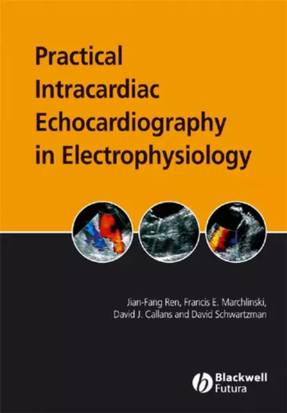 Обложка книги Practical Intracardiac Echocardiography in Electrophysiology, Jian-Fang  Ren