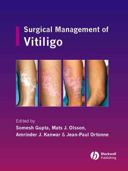 Somesh  Gupta - Surgical Management of Vitiligo