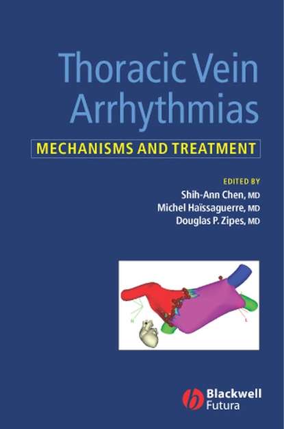 Michel  Haissaguerre - Thoracic Vein Arrhythmias