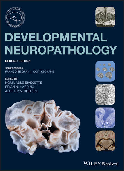 Homa  Adle-Biassette - Developmental Neuropathology