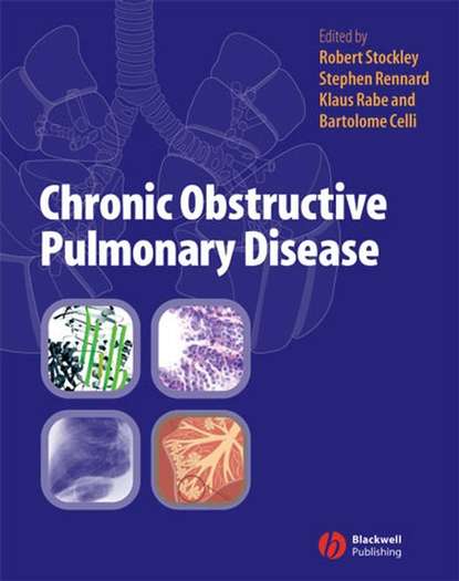 Chronic Obstructive Pulmonary Disease (Klaus  Rabe). 