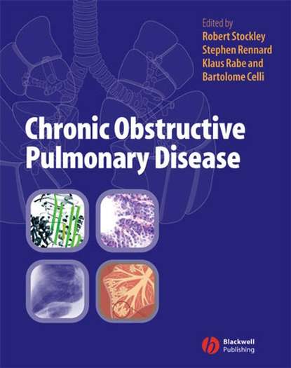 Klaus  Rabe - Chronic Obstructive Pulmonary Disease