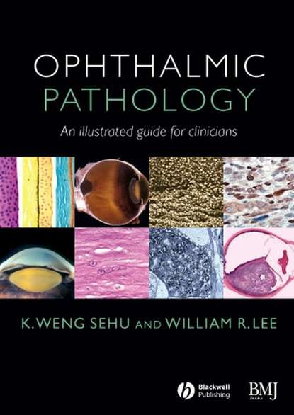 Ophthalmic Pathology - William Lee R.