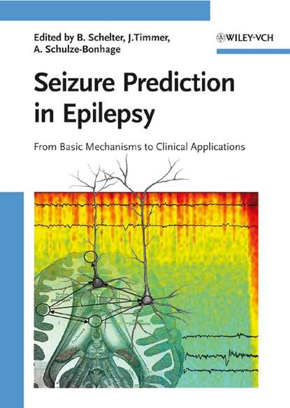 Jens  Timmer - Seizure Prediction in Epilepsy
