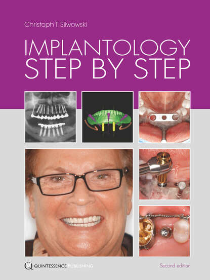 Christoph T. Sliwowski - Implantology Step by Step