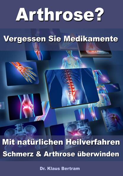 Arthrose? - Vergessen Sie Medikamente - Mit natürlichen Heilverfahren Schmerz & Arthrose überwinden (Dr. Klaus Bertram). 