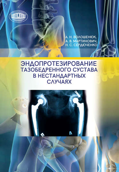 Александр Волошенюк - Эндопротезирование тазобедренного сустава в нестандартных случаях