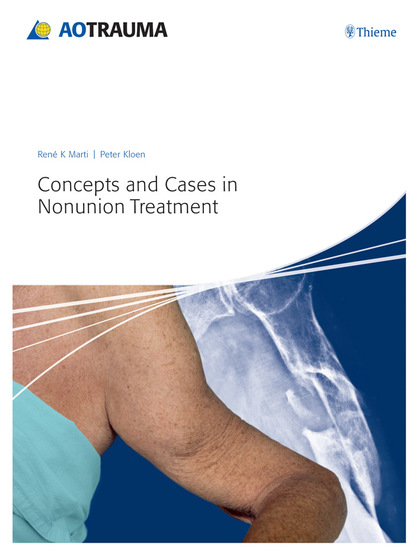 Ren K. Marti - Concepts and Cases in Nonunion Treatment