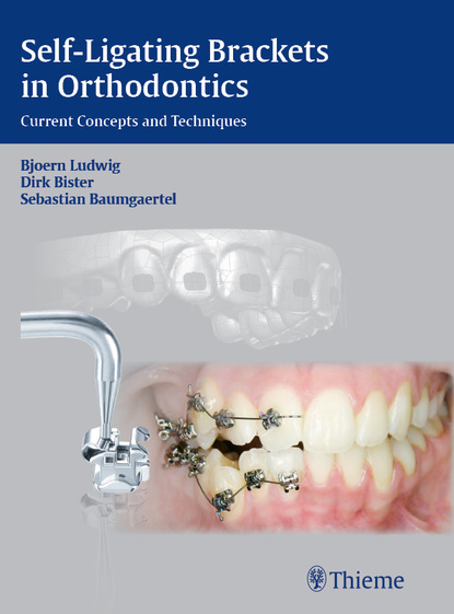 Bjoern Ludwig - Self-ligating Brackets in Orthodontics