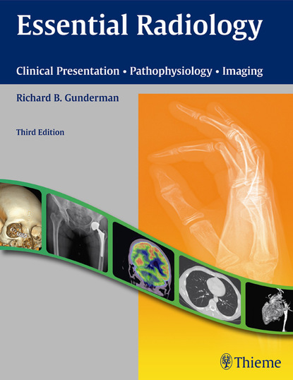 Richard B. Gunderman - Essential Radiology