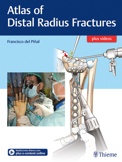 

Atlas of Distal Radius Fractures