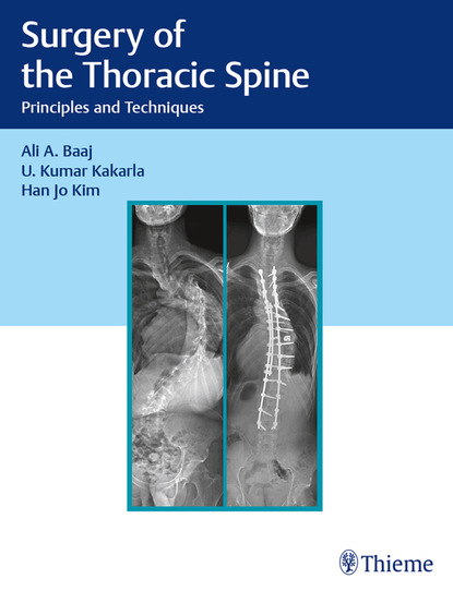 Ali A. Baaj - Surgery of the Thoracic Spine