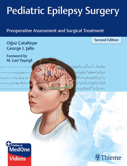 Oguz Cataltepe - Pediatric Epilepsy Surgery