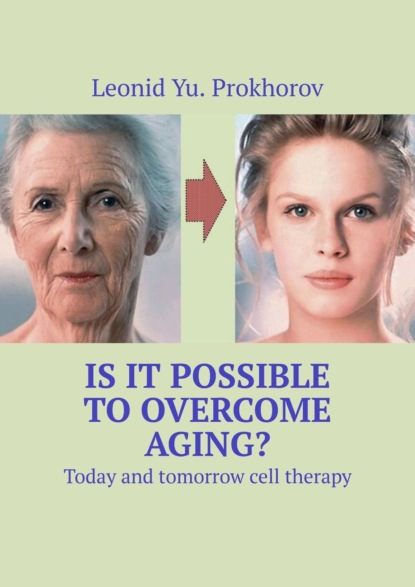 Is it possible toovercome aging? Today and tomorrow cell therapy
