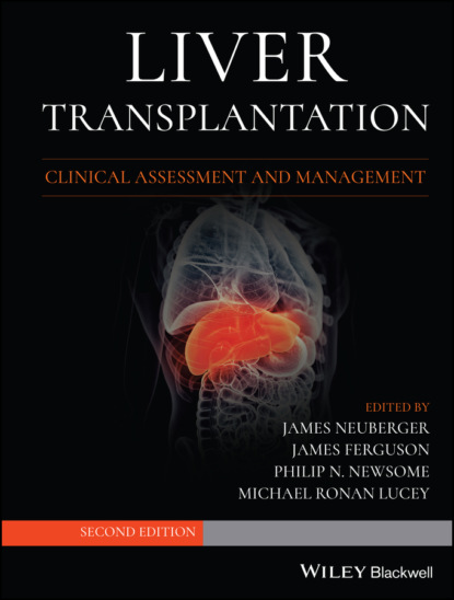 Liver Transplantation - Группа авторов