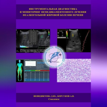 Аудиокнига Инструментальная диагностика и мониторинг немедикаментозного лечения неалкогольной жировой болезни печени ISBN 