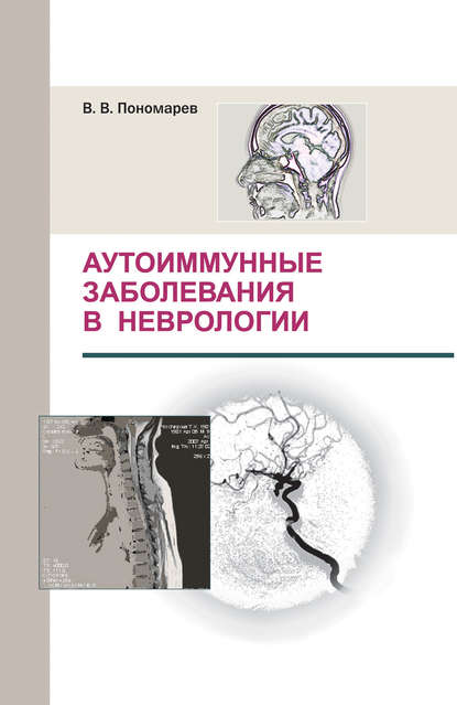В. В. Пономарев — Аутоиммунные заболевания в неврологии