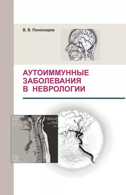 Обложка книги Аутоиммунные заболевания в неврологии, В. В. Пономарев