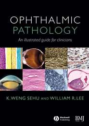 Ophthalmic Pathology