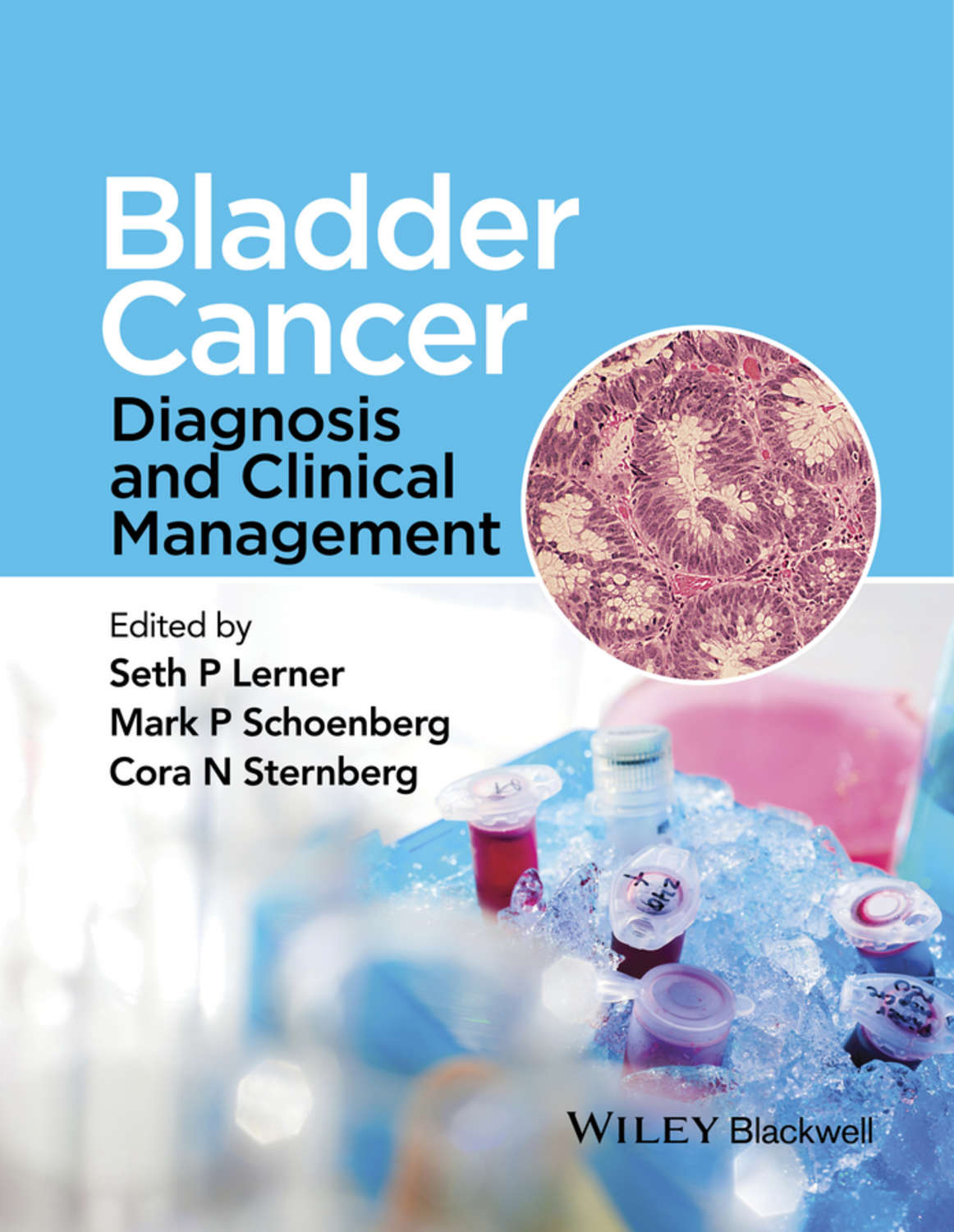 bladder-cancer-pdf